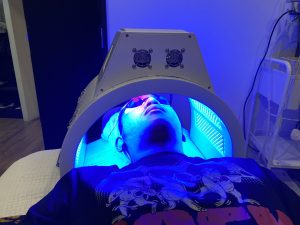 Traitement à la lumière pulsée