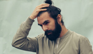 perte cheveux homme