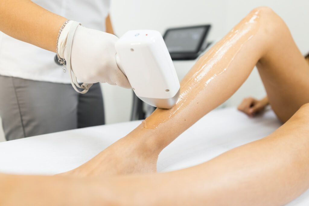 Epilation au laser à Nice