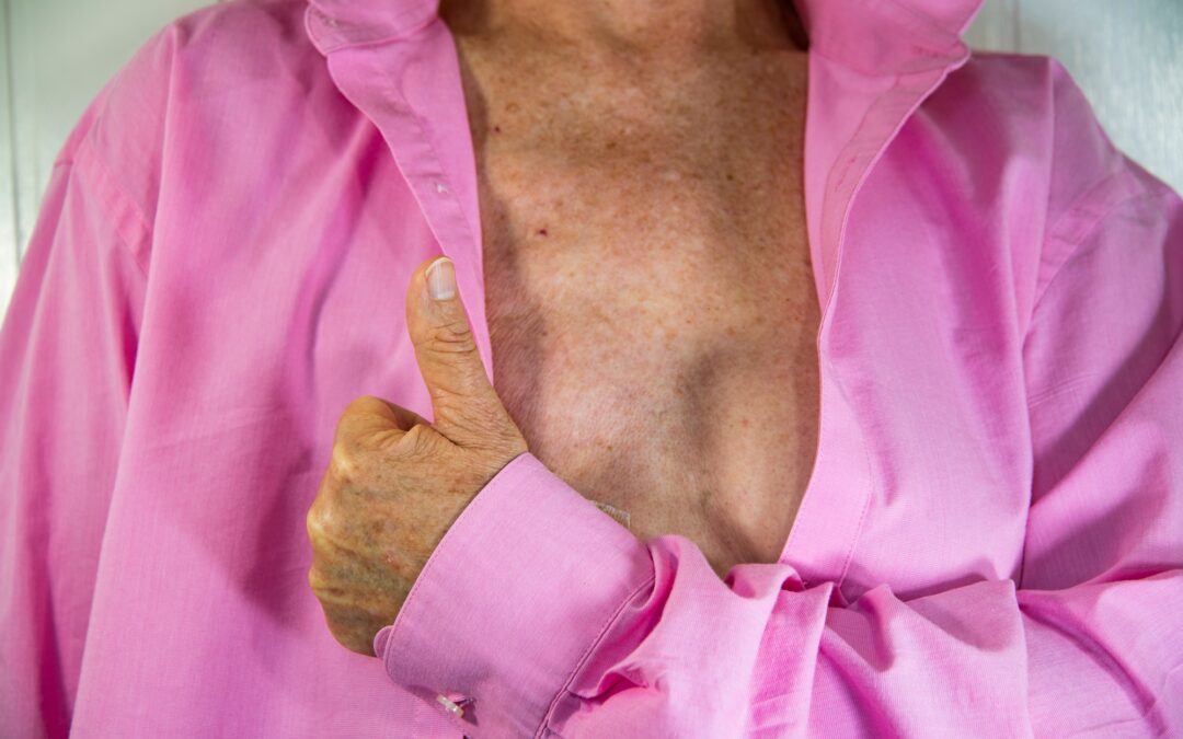 J’ai choisi une reconstruction mammaire après une mastectomie : mon histoire