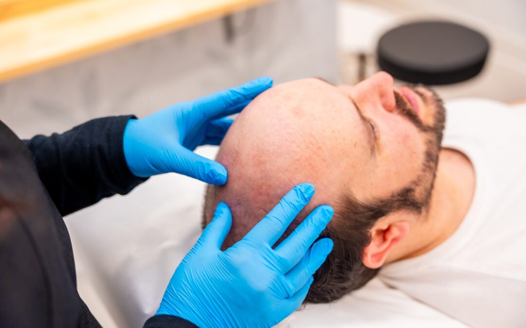 Les bénéfices des traitements LED pour la calvitie : une approche non invasive
